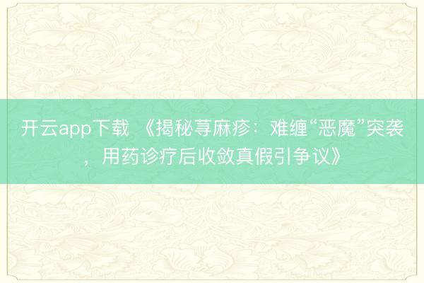 开云app下载 《揭秘荨麻疹:难缠“恶魔”突袭,用药诊疗后收敛真假引争议》